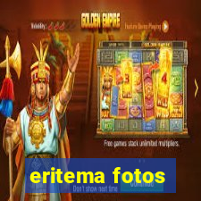 eritema fotos